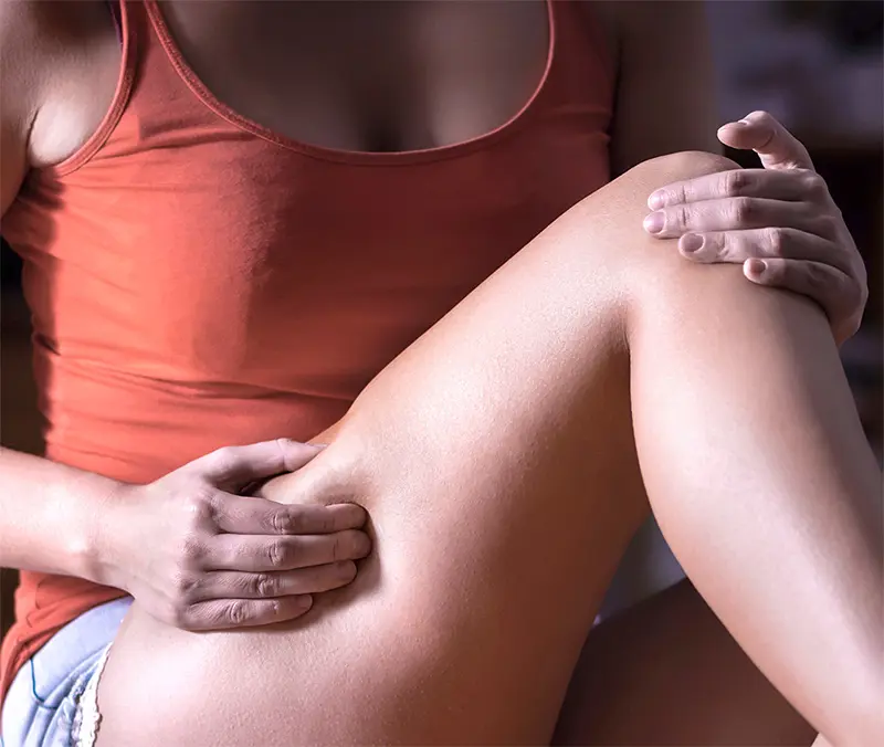 Examinar piernas varices