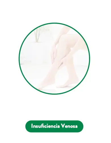 Insuficiencia venosa
