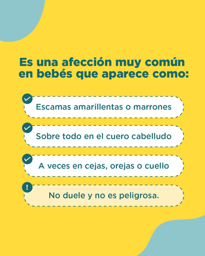 síntomas de la costra láctea