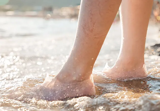 Consejos para ir a la playa con varices
