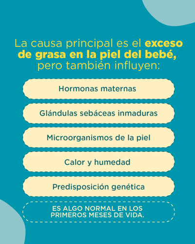 causas de la costra láctea
