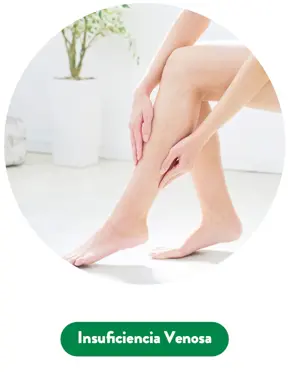 Insificiencia venosa