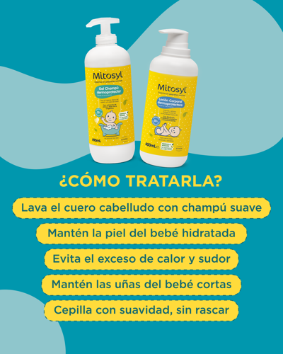 cómo tratar la costra láctea